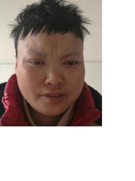 流浪人员无名氏074照片，让爱回家