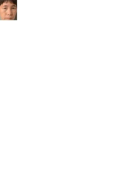 流浪人员36无名氏女（康复医院）照片，让爱回家