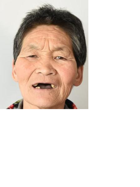 流浪人员莱阳无名女5照片，让爱回家