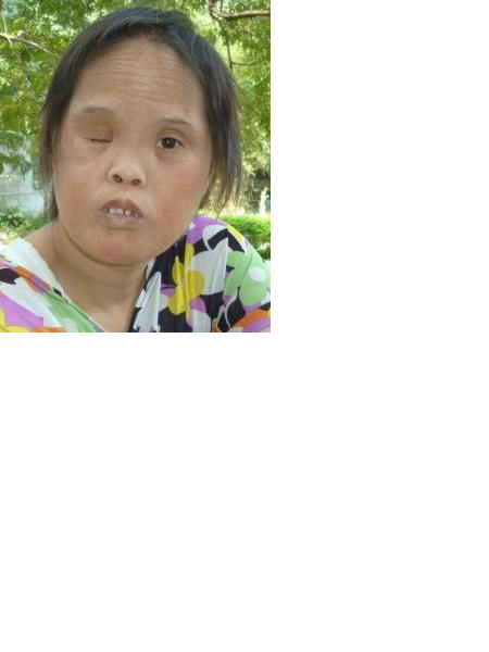 流浪人员无名女照片，让爱回家