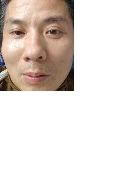 流浪人员上救151照片，让爱回家