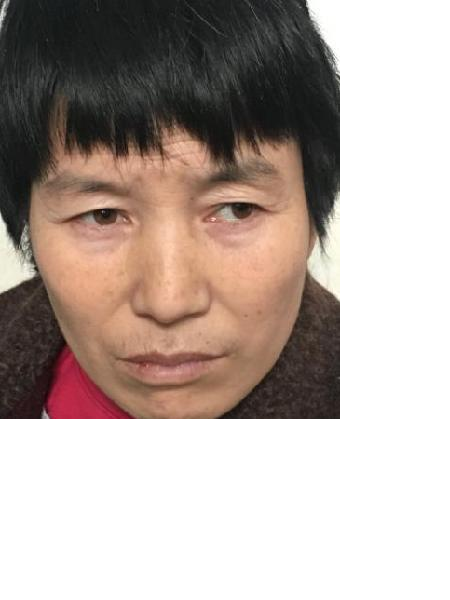 流浪人员无名氏15014号照片，让爱回家