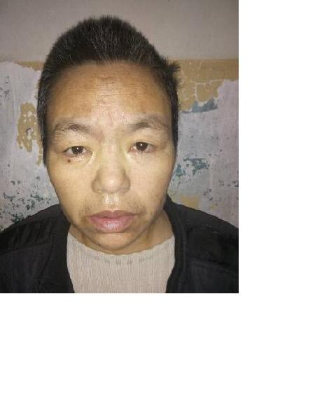 流浪人员衡救A275照片，让爱回家