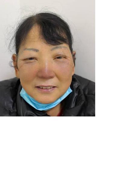 流浪人员周金荣照片，让爱回家