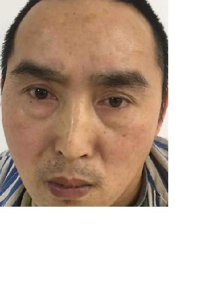 流浪人员044无名氏男(康复医院)照片，让爱回家