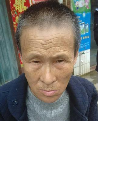 流浪人员梅救3照片，让爱回家