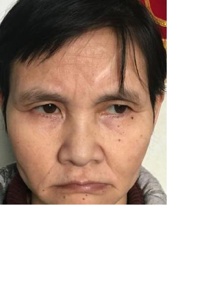 流浪人员无名氏15012号照片，让爱回家