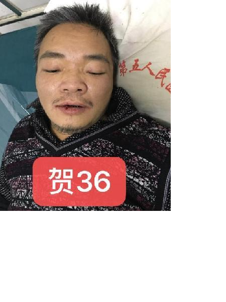 流浪人员贺36（黄雨良）照片，让爱回家