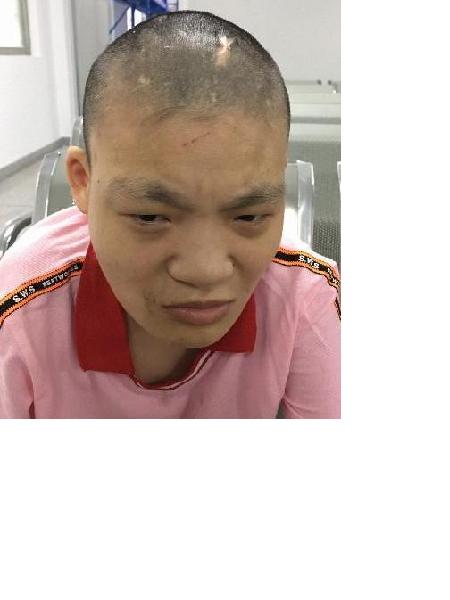 流浪人员无名氏（花都妹）照片，让爱回家