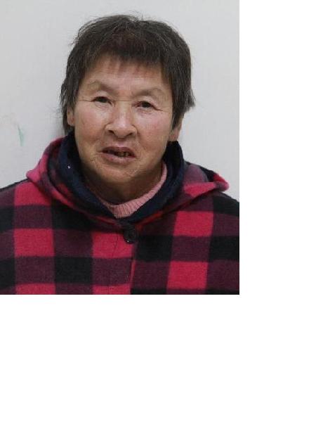 流浪人员无名氏（宜救妙）照片，让爱回家