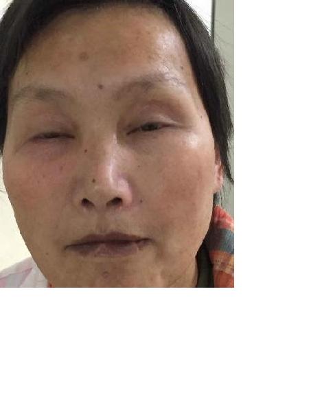 流浪人员14刘华英女（康复医院）照片，让爱回家