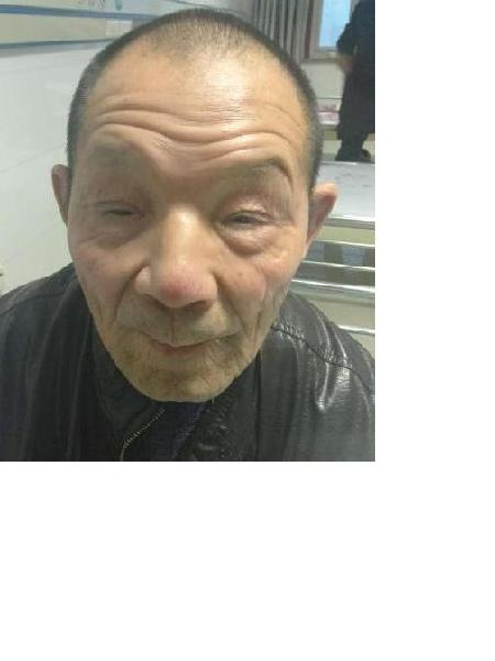 流浪人员陈宏昌照片，让爱回家