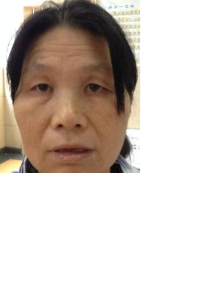 流浪人员无名氏福才芬照片，让爱回家