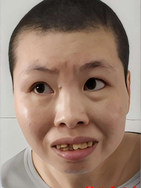 失踪人员于青芳照片，让爱回家