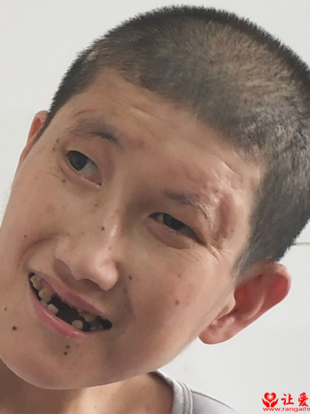 失踪人员秦八妹照片，让爱回家