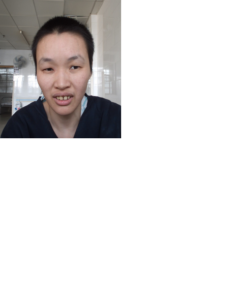 失踪人员尤慕萍照片，让爱回家