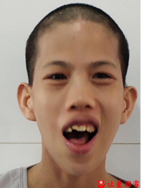 失踪人员于婉芳照片，让爱回家