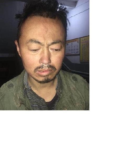 流浪人员张立球照片，让爱回家