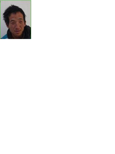 流浪人员无名氏华医照片，让爱回家