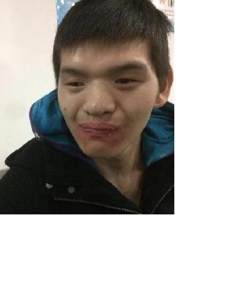 流浪人员无名男照片，让爱回家