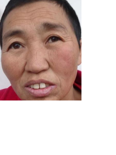 流浪人员无名女照片，让爱回家
