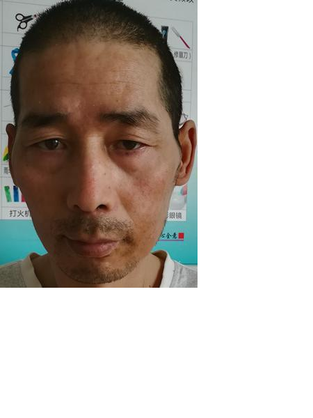 流浪人员无名（蒲正发）照片，让爱回家
