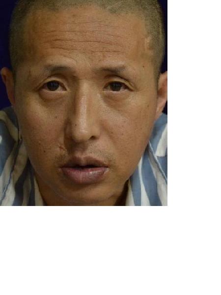 流浪人员衡救A248照片，让爱回家