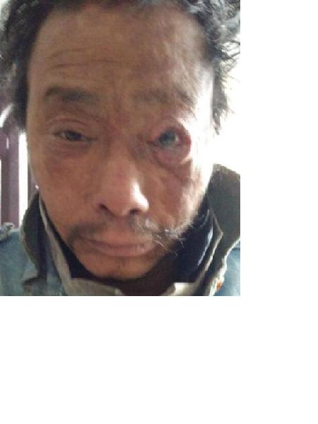 流浪人员无名男20161123照片，让爱回家