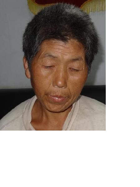 流浪人员无名氏（杨临江）照片，让爱回家