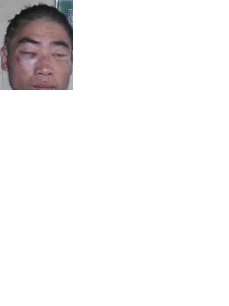 流浪人员无名氏BAM20130702照片，让爱回家