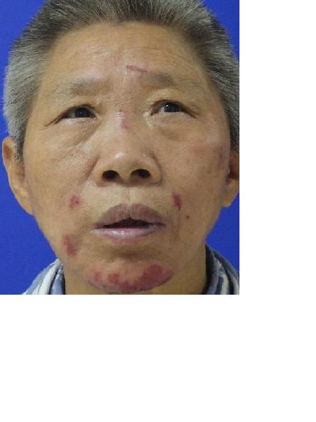 流浪人员衡救A147照片，让爱回家