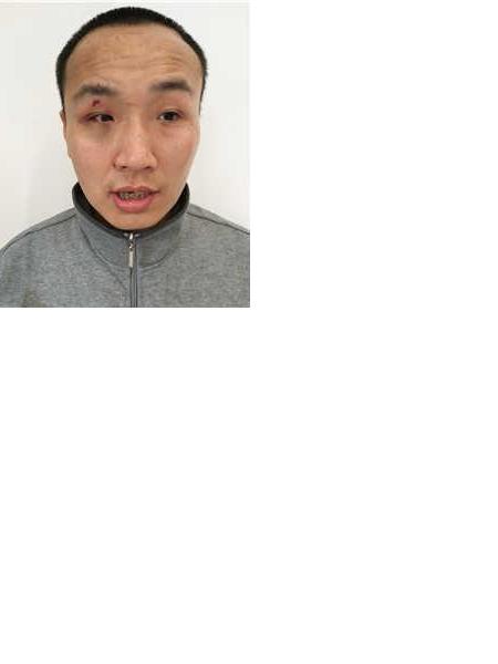 流浪人员惠JA28/S053902/深B114照片，让爱回家