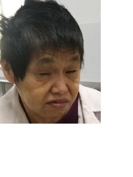 流浪人员45无名氏女（康复医院）照片，让爱回家
