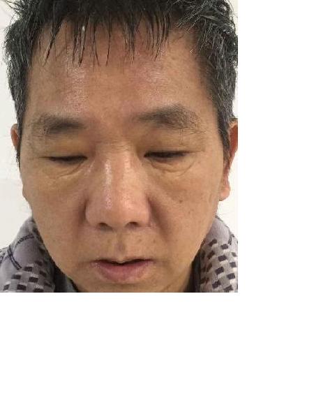 流浪人员032无名氏男康复医院照片，让爱回家