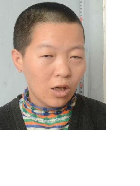 流浪人员038无名氏女（康复医院）照片，让爱回家