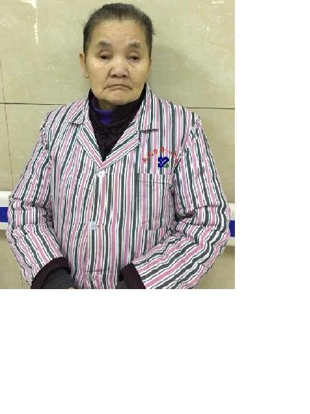 流浪人员无名女101照片，让爱回家