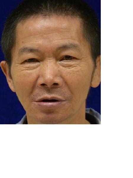 流浪人员衡救A184照片，让爱回家