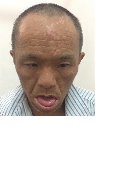 流浪人员无名男5照片，让爱回家
