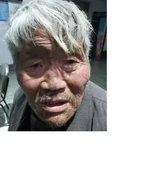 流浪人员无名男照片，让爱回家