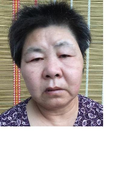 流浪人员无名女照片，让爱回家