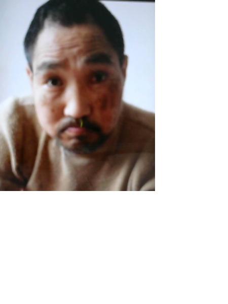 流浪人员无名氏16号照片，让爱回家