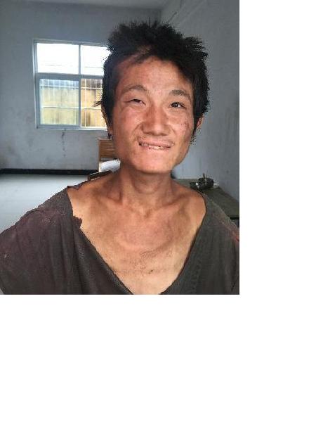流浪人员无名男照片，让爱回家