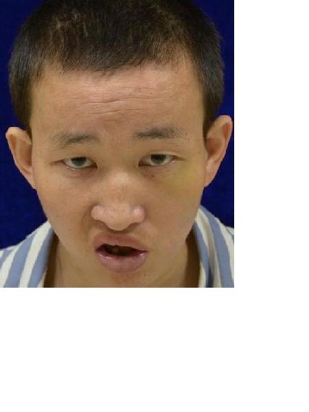 流浪人员衡救A181照片，让爱回家