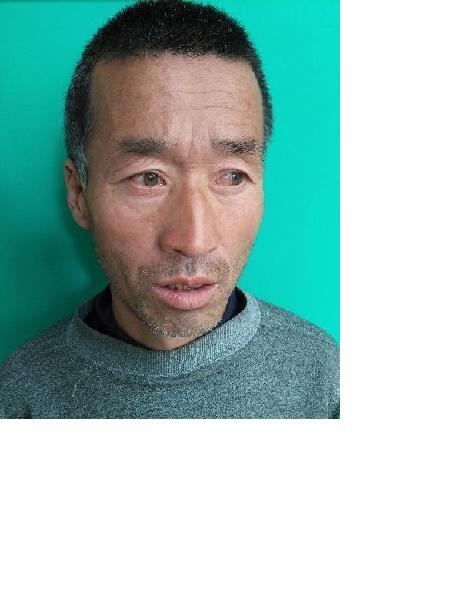 流浪人员无名氏12照片，让爱回家