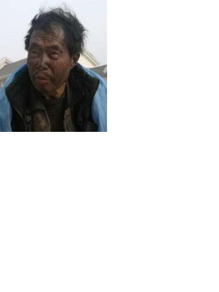 流浪人员无名氏1703照片，让爱回家