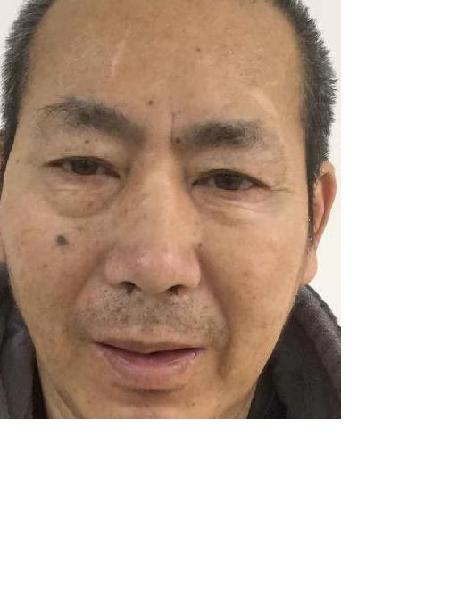 流浪人员039无名氏男(康复医院)照片，让爱回家