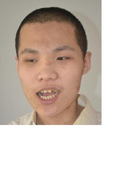 流浪人员不清照片，让爱回家