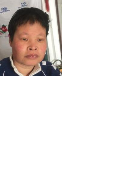 流浪人员戴小红照片，让爱回家