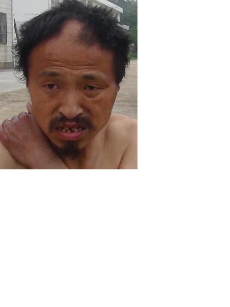 流浪人员无名氏照片，让爱回家