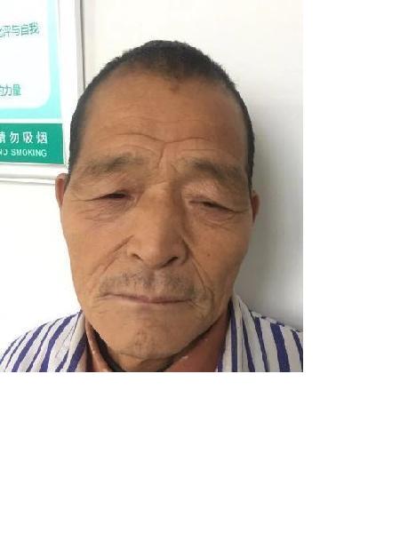 流浪人员无名男0927照片，让爱回家